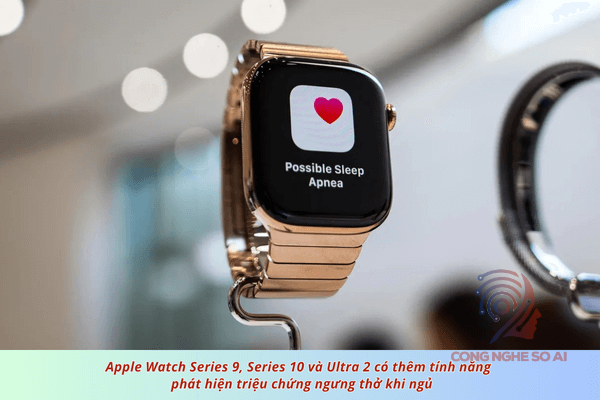 Nên mua apple watch nào